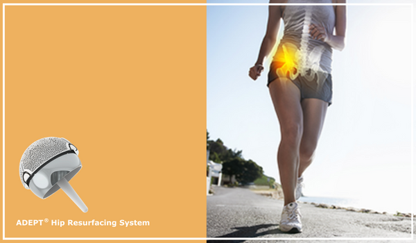 Copy of Long-term Outcomes of Hip Replacement (1)