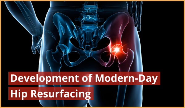 Copy of Development of Modern-Day Hip Resurfacing 1 (600 x 350 px) (2)